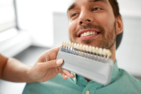 How Long Will Dental Veneers Last?