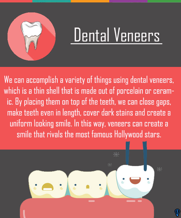 Dental Veneers and Dental Laminates Fairborn, OH
