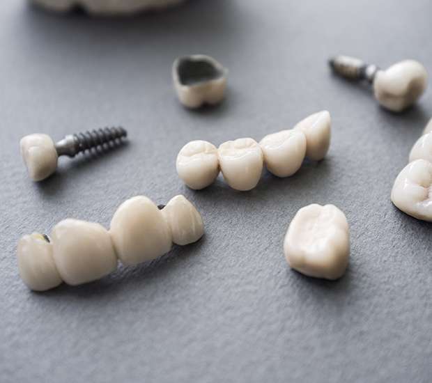 Fairborn The Difference Between Dental Implants and Mini Dental Implants