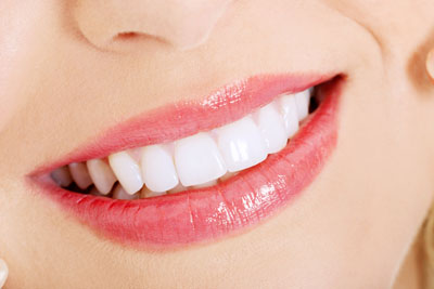 How Long Does It Take To Whiten Your Teeth?
